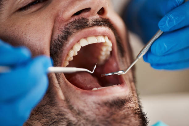 Best Emergency Dental Care for Abscessed Tooth in Pis, AR